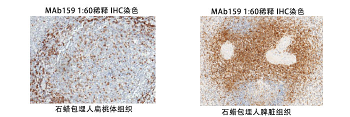 鼠抗人CD3抗體案例