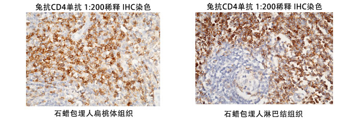 兔抗人CD4抗體案例